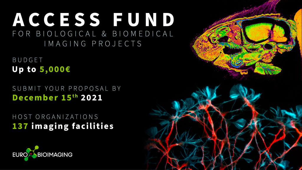 APPLY FUNDING FOR YOUR EURO-BIOIMAGING PROJECT – Deadline December 15, 2022