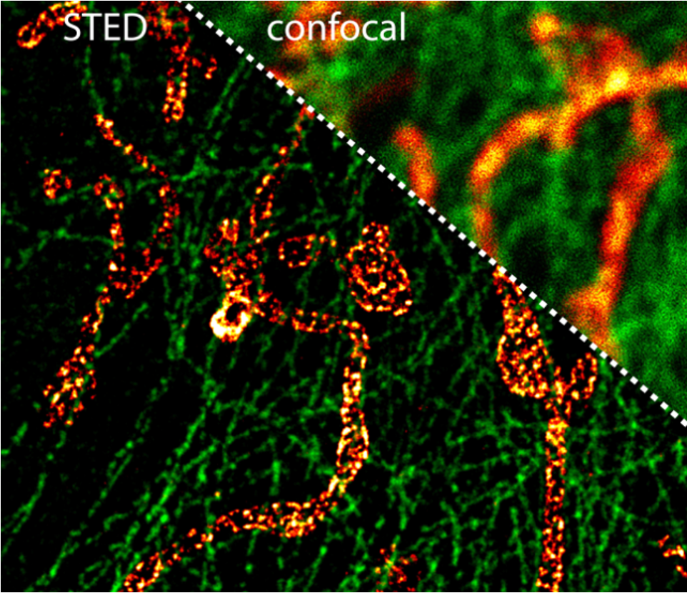 Super-Resolution Facility Staff/Researcher Event on STED Microscopy￼ – March 15-16, 2022